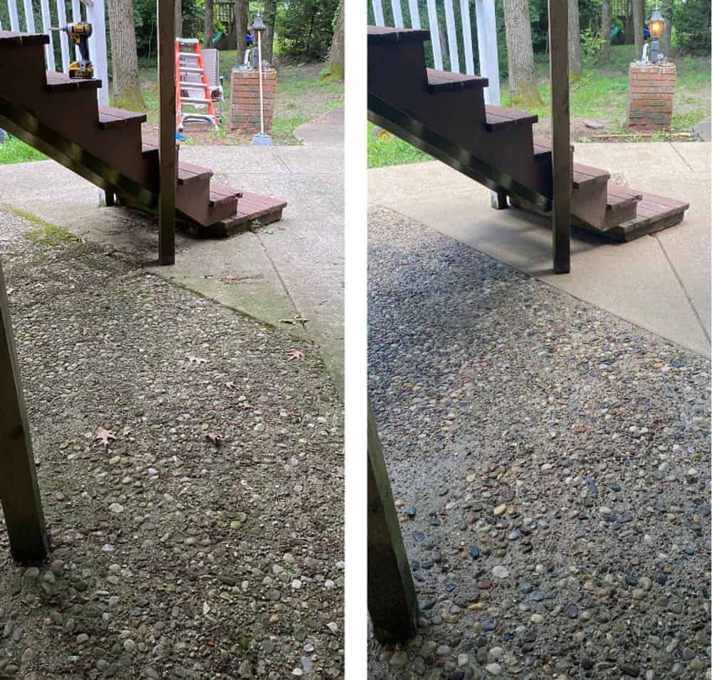 Gum and Stain Removal image